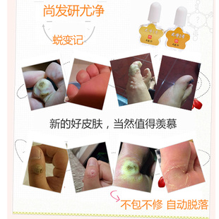 尚发研尤净套装 131一盒 一次性买两盒送一盒