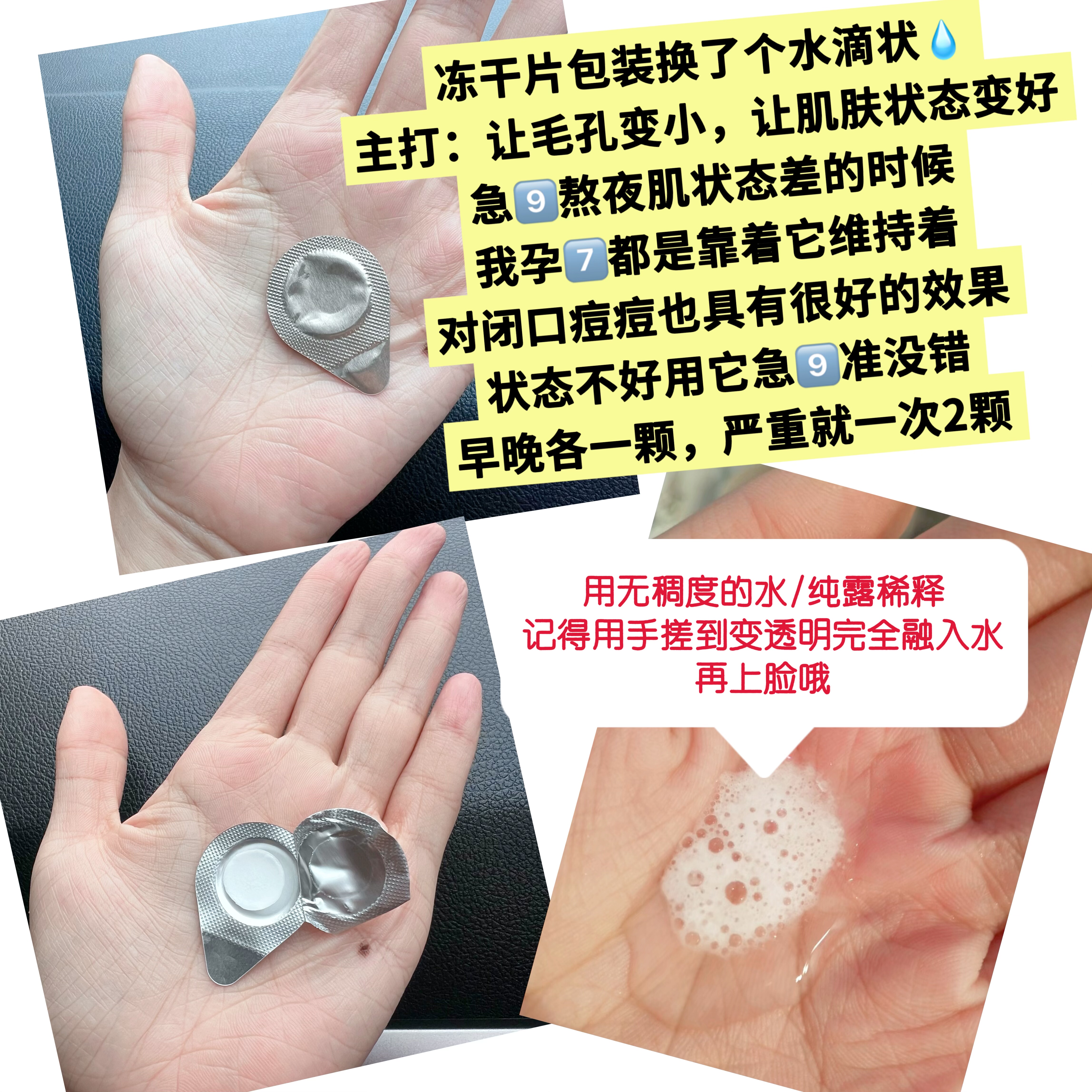 德国技术寡肽冻干粉去红祛血丝