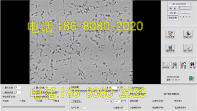 精子分析软件，显微镜，精液检测