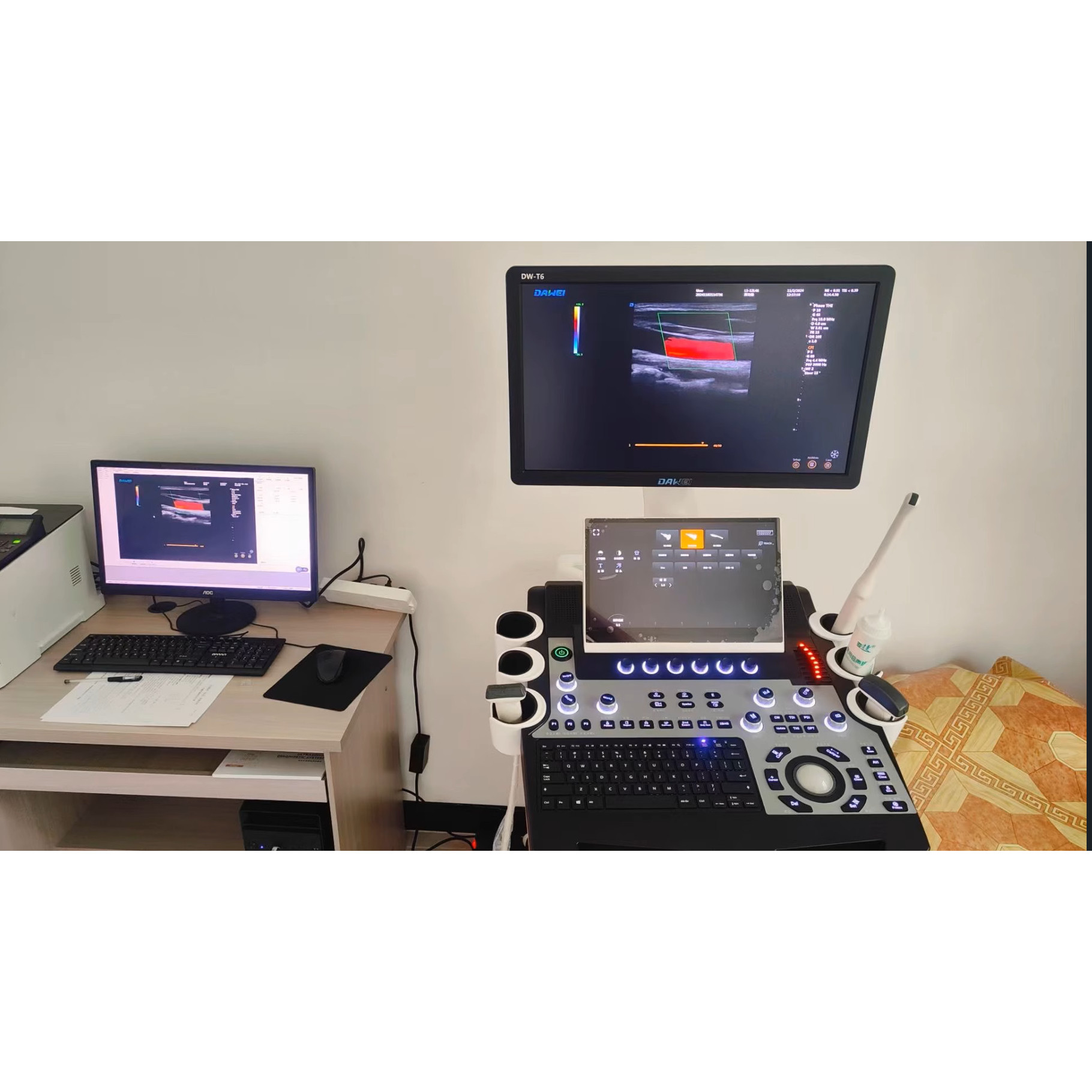 B超工作站超声图文高清彩超软件超声影像工作站B超高清版win10 11