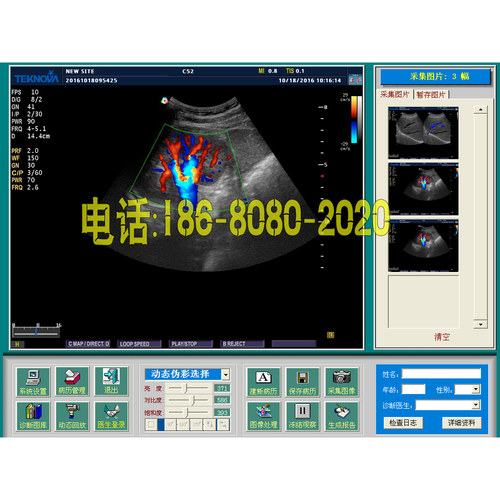 宝兴彩超工作站软件B超工作站B超报告软件B超软件B超影像软件XP版