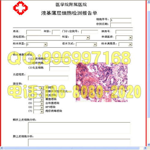 液基细胞报告软件液基细胞检测软件TCT软件随心所欲软件XP版
