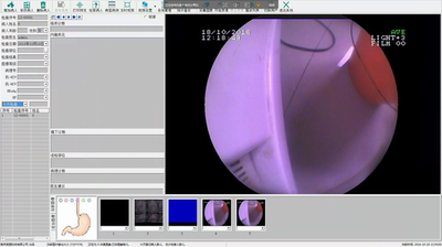 索图内窥镜软件胃镜软件宫腔镜软件腹腔镜软件支气管镜win7/10版