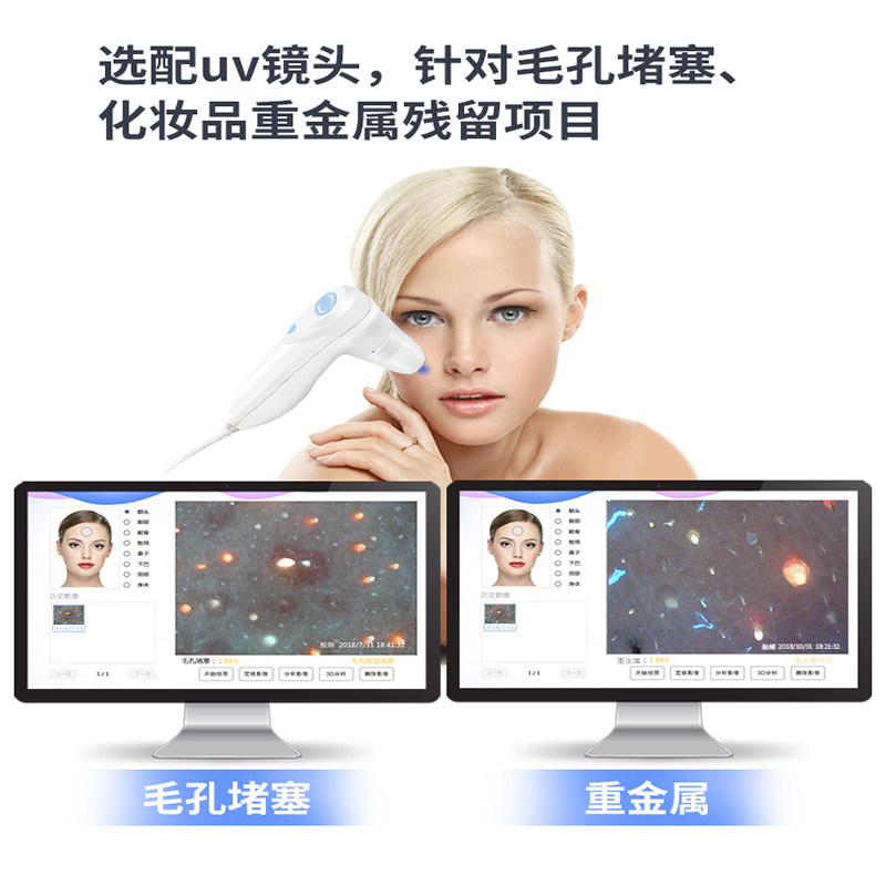 50倍UV镜头看毛孔毛囊堵塞发炎头皮皮肤重金属留皮肤毛发仪器配件