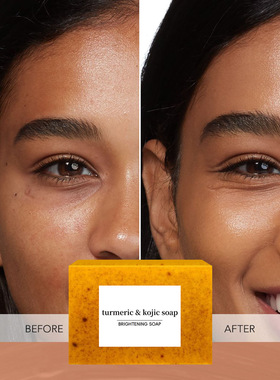 TK Turmeric Soap Lemon Soap Tartaric Soap Ginger Handmade Co