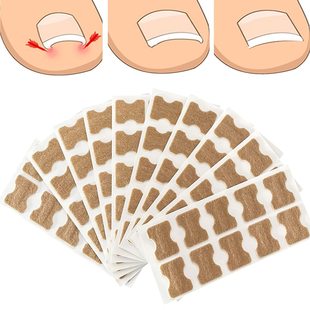 Nail groove adhesive free nail sticker, embedded nail correc
