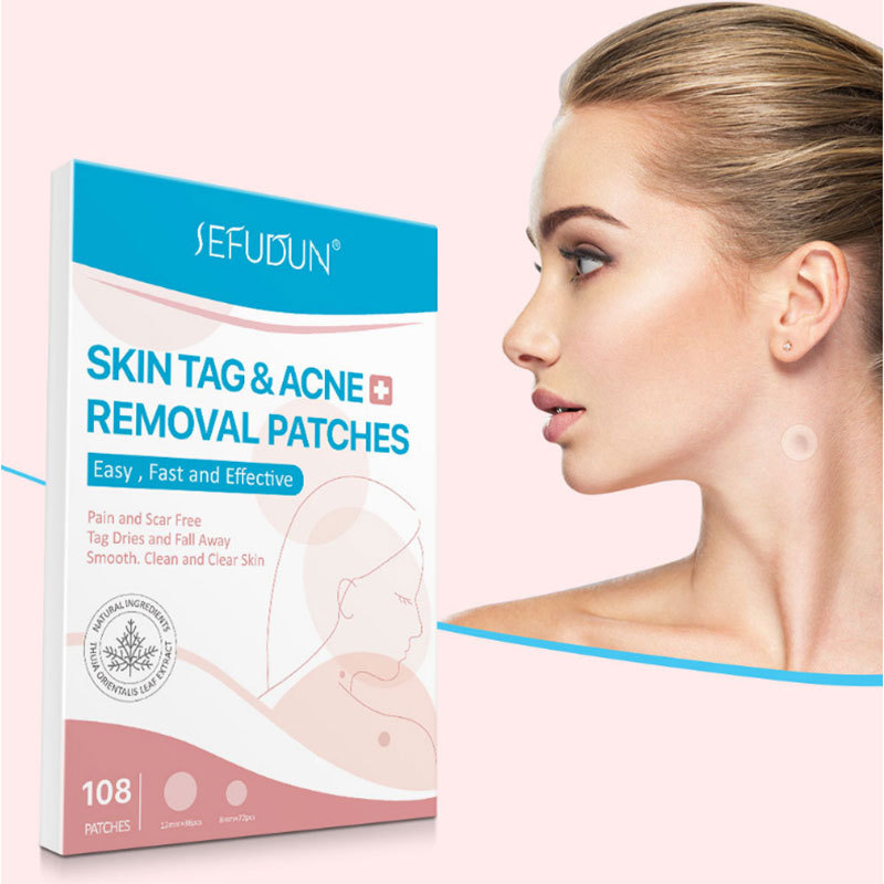 克忧祛疣贴肉刺扁平瘊脸部疣