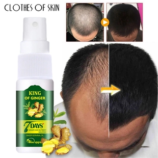 Hair Growth Product Anti Hair Loss Baldness Spray生姜育发液