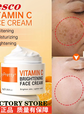 Face Cream Vitamin C Remove Dark Spots Whitening Skin Care