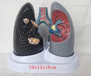 健康肺模型人类内脏 人体吸烟癌变肺模型 吸烟肺与健康肺模型