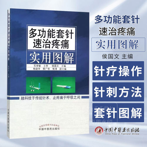 疼痛针灸疗法