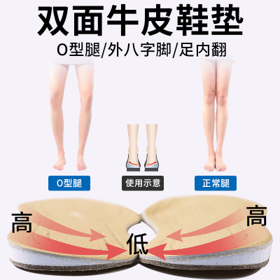 牛皮O型腿外八字足内翻矫正鞋垫