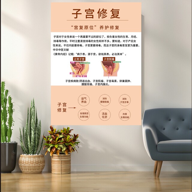 宫颈疾病示意图妇科门诊宣传海报病变子宫挂图女性生殖系统解剖图