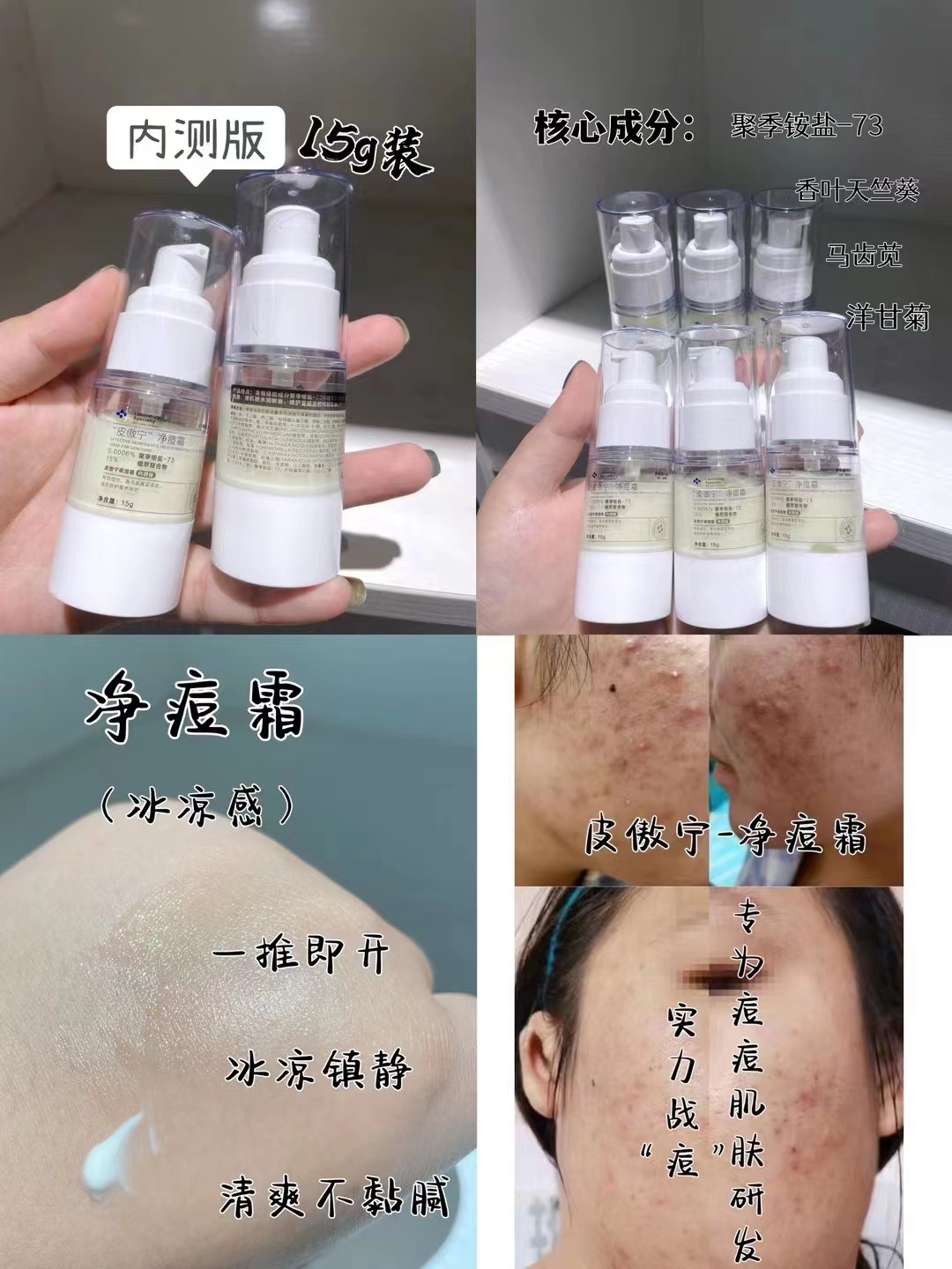 祛痘膏内测版15g 草本味道超级浓郁 红肿痘克星