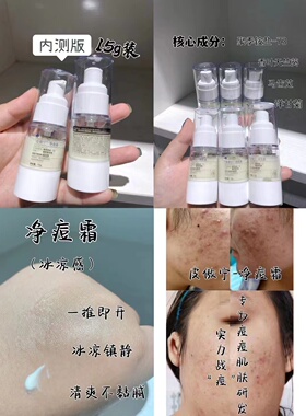 祛痘膏内测版15g 草本味道超级浓郁 改善红肿豆