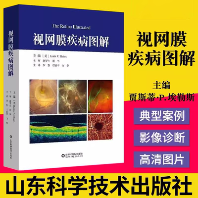 【书】视网膜疾病图解 先进的视网膜成像技术超宽视野血管造影术中光学相干断层扫描OCT血管成像黄斑变性血管病感染炎症创伤疾病