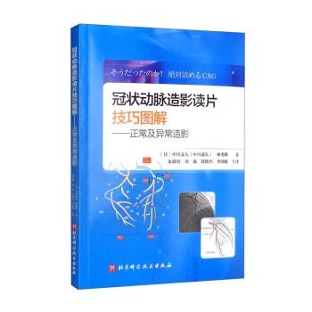 【r】 冠状动脉造影读片技巧图解:正常及异常造影 9787571419929 北京科学技术出版社4