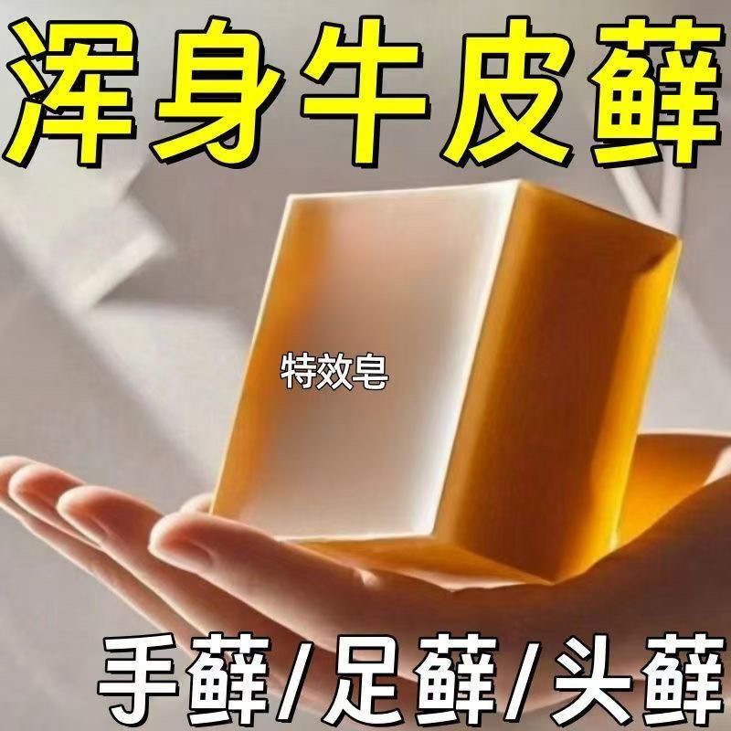 【洗完不再痒】牛皮癣皂头皮股银去屑病皮肤止痒杀菌肤康藓皂正品