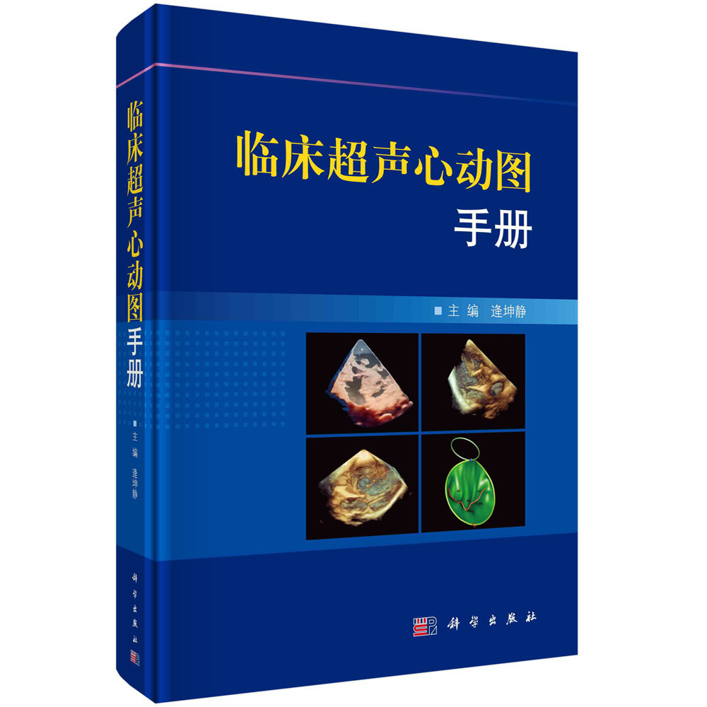 临床超声心动图手册  逄坤静  科学出版社
