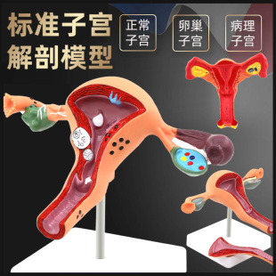人体女性生殖子宫解剖病理模型 妇科生殖科教具 阴道卵巢教学模型