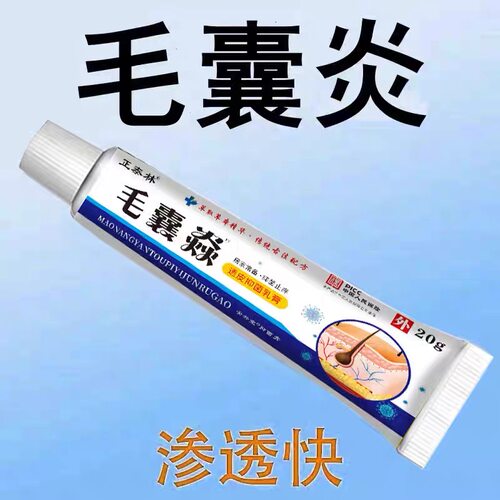 头上长痘痘脓包疙瘩头毛囊炎脓疮毛囊发炎堵塞抑菌止痒乳膏