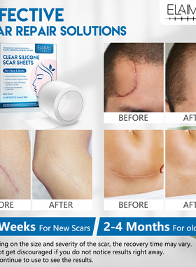 外贸ELAIMEI硅凝胶隐形面部淡疤卷手术伤疤修护贴淡化烧烫疤痕贴