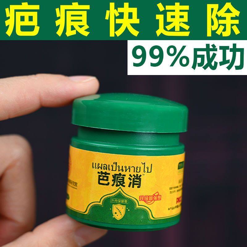 各种疤/疤烫伤疤痘印痘坑色素疤疤痕体质非遮瑕膏遮瑕,洗护清洁剂/卫生巾/纸/香薰,身体乳液,淘宝优惠券,粉丝福利购,淘宝优惠卷