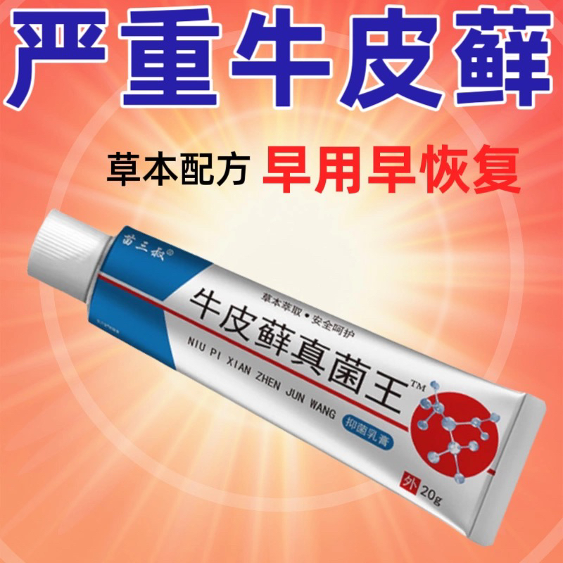 正品真菌王银屑牛皮癣手足癣湿疹皮炎皮肤瘙痒真菌感染药膏