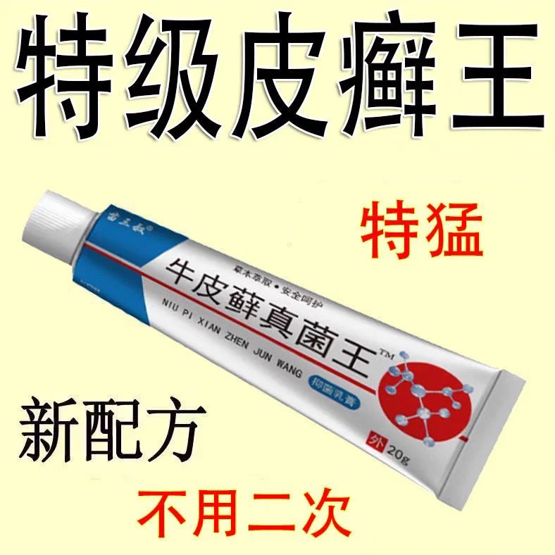 正品牛皮癣真菌王银屑牛皮癣手足癣湿疹皮炎皮肤瘙痒真菌感染药膏