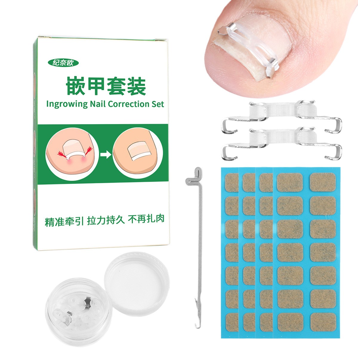 正甲扣拉拉扣甲沟嵌甲矫正器指甲美甲/修甲套装