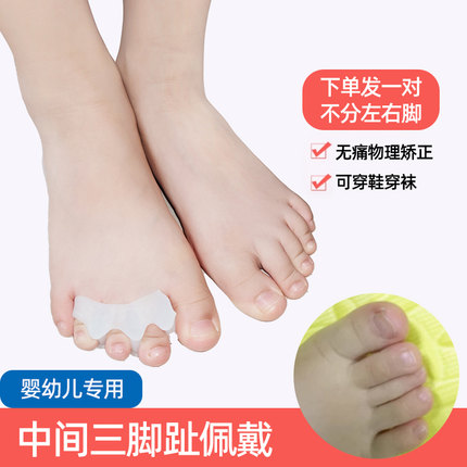 中间三脚趾款 婴儿脚趾矫正器儿童宝宝重叠分趾器小孩拇指外翻