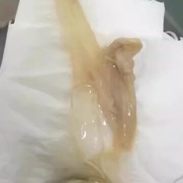 热销1万hpv妇科私处百味糜腐月经黑异味霉菌腥臭熹清宫美颜丹干扰