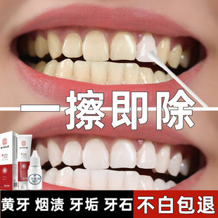 强力去烟渍牙膏去黄去口臭美白亮白除牙垢结石溶解神器男女士专用