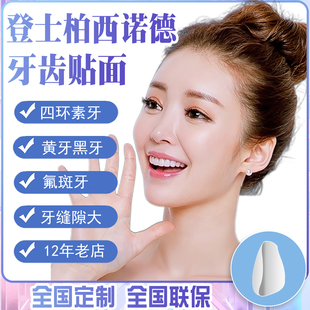 定做四环素氟斑牙黄牙黑牙缝隙稀疏登士柏灵犀瓷全瓷贴面牙齿贴片