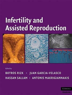 【预售】Infertitlity and Assisted Reproduction