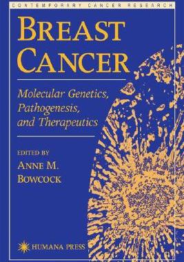 【预售】Breast Cancer: Molecular Genetics, Pathogenesis, and