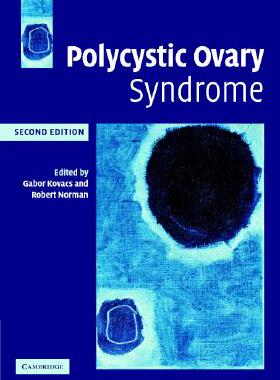【预售】Polycystic Ovary Syndrome