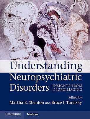 【预售】Understanding Neuropsychiatric Disorders: Insights