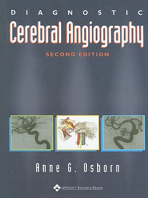 【预订】Diagnostic Cerebral Angiography