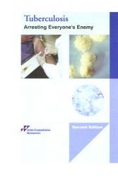 【预订】Tuberculosis: Arresting Everyone's Enemy