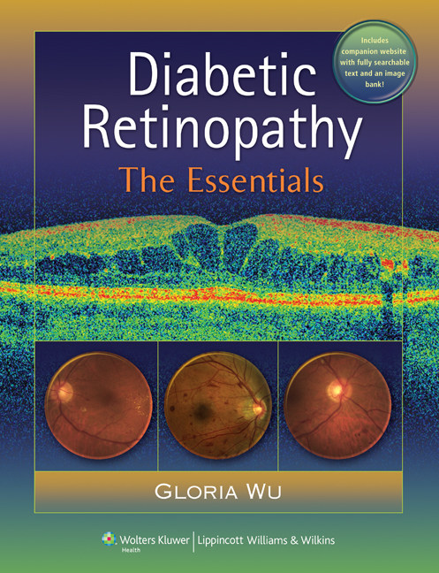 【预订】diabetic retinopathy : the essentials
