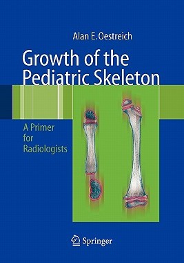 【预售】Growth of the Pediatric Skeleton: A Primer for