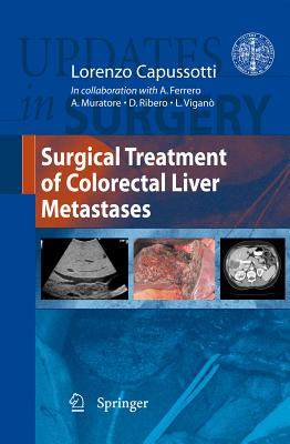 【预售】surgical treatment of colorectal liver metastases