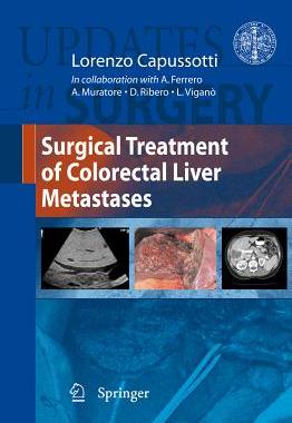 【预售】Surgical Treatment of Colorectal Liver Metastases