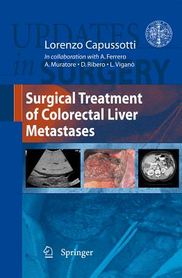 【预售】Surgical Treatment of Colorectal Liver Metastases