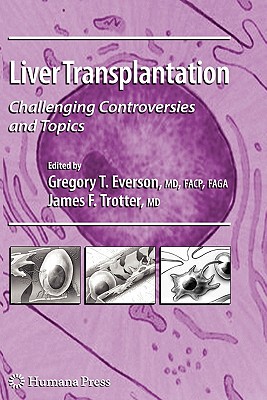 【预售】Liver Transplantation: Challenging Controversies and
