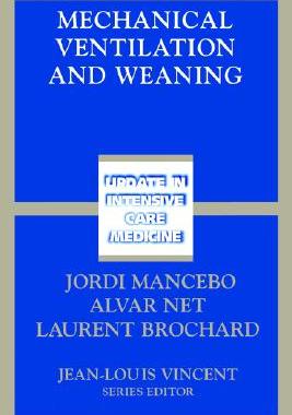 【预售】Mechanical Ventilation and Weaning