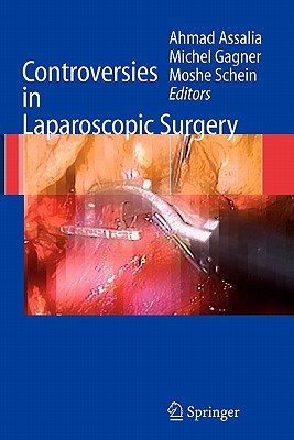 【预售】Controversies in Laparoscopic Surgery