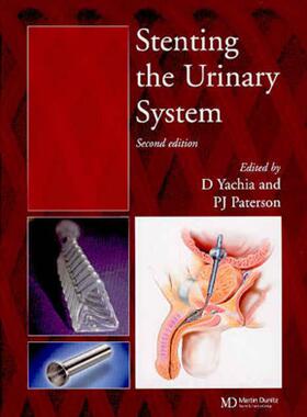 【预售】Stenting the Urinary System