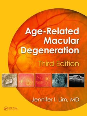 【预售】Age-Related Macular Degeneration